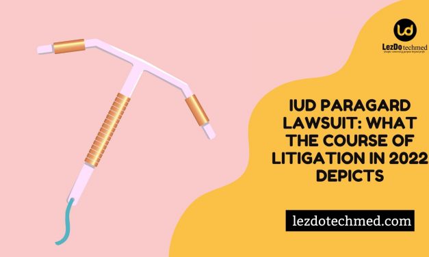 IUD Paragard Lawsuit: What the course of Litigation in 2022 Depicts