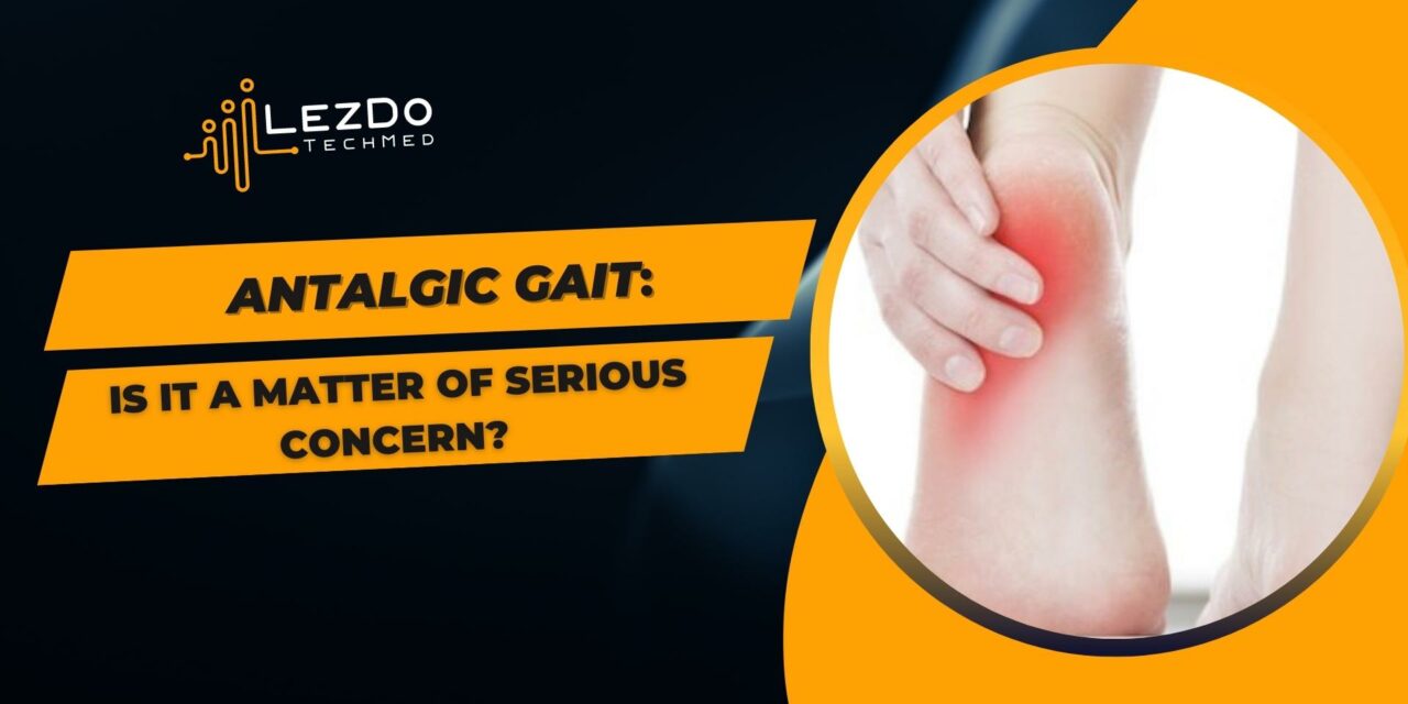 Antalgic Gait: Is it a Matter of Serious Concern?