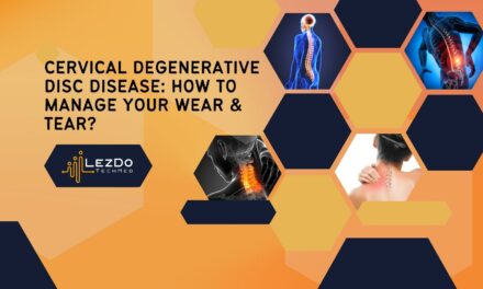 Cervical Degenerative Disc Disease: How to Manage Your Wear & Tear?