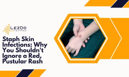 Staph Skin Infections: Why You Shouldn’t Ignore a Red, Pustular Rash