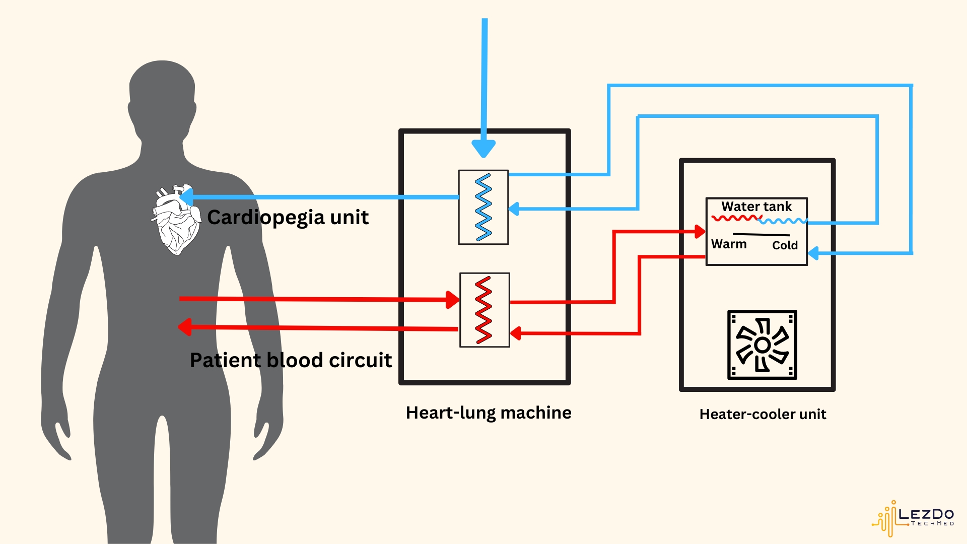heater-cooler-infection-picture-shows-heater-cooler-device